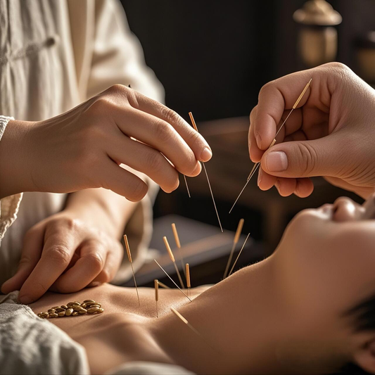 Illustrative traditional Chinese acupuncture treatment with fine needles